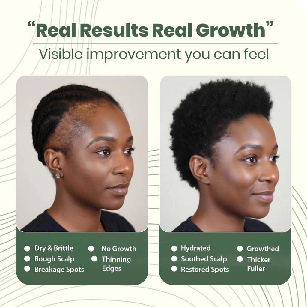 Batana Natural Hair Growth Oil